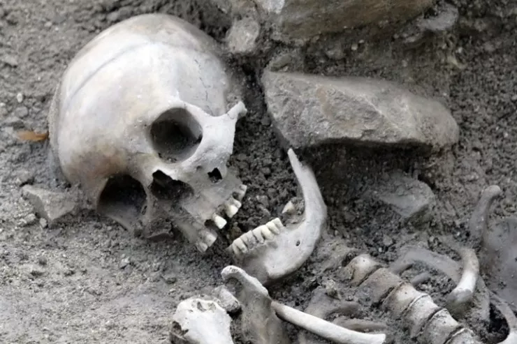 Kişi pul almaq üçün bacısının sümüklərini  banka gətirdi