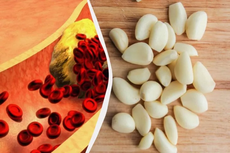 Xolesterini salmaq üçün bu qidanı çiy yeyin – Alimlər 5 təsirini açıqladı 