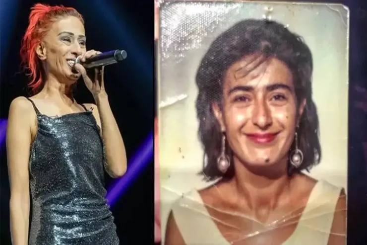 Yıldız Tilbedən illər sonra ETİRAF:  “Uşaqlıqda qulağımı itirdim”