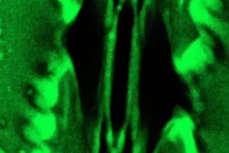 Elmi dünyada bir ilk : Bitkilərin tənəffüsü belə olur - VİDEO 