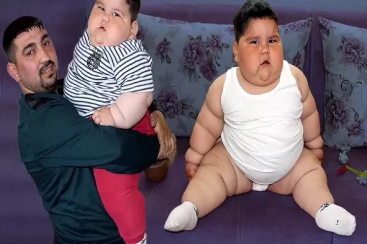 5 yaşında 90 kilo idi, 6 il sonra tanınmaz hala  düşdü