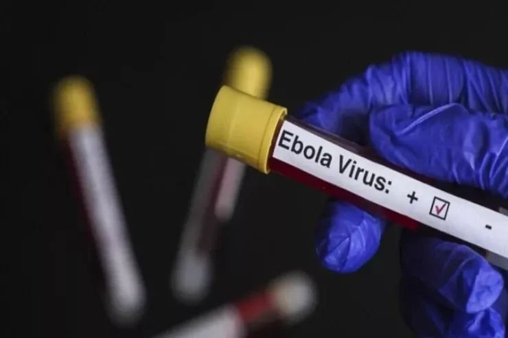 ÜST Ebola virusu riski altında  olan ölkələri açıqladı