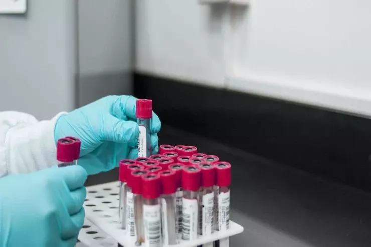 Qan testi nə qədər yaşayacağınızı  göstərəcək