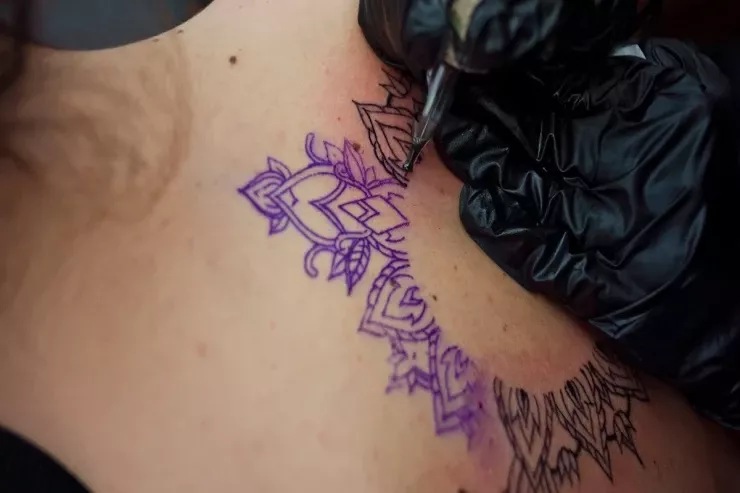 Döymə etdirənlər kor  ola bilər - XƏBƏRDARLIQ  