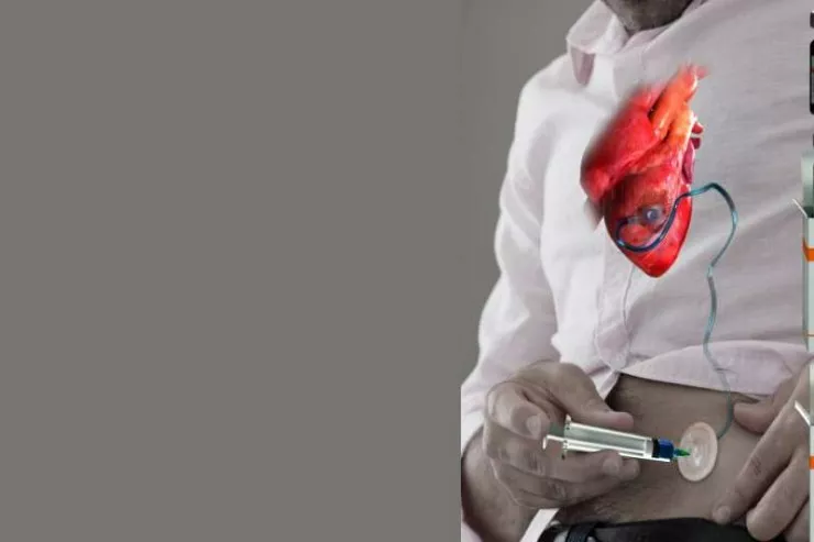İnfakrtdan sonra ürəyi bərpa edəcək iynə  hazırlandı