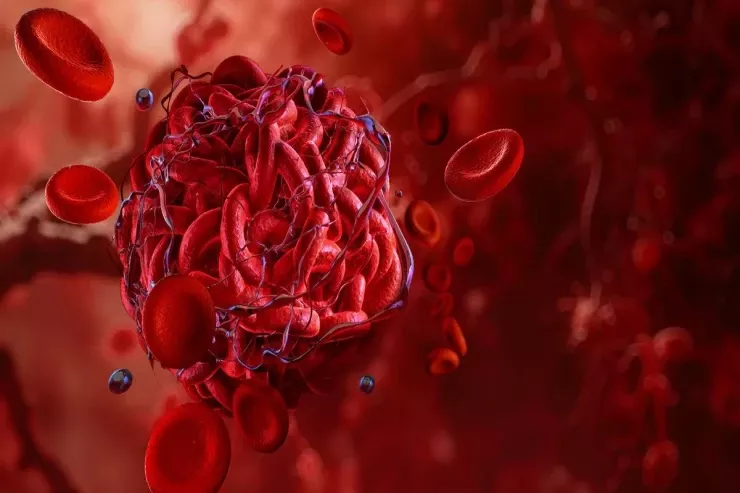 Tromb ola biləcəyini göstərən əsas narahatedici ƏLAMƏTLƏR 