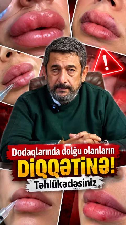 Dodaqlarında dolğu olanların DİQQƏTİNƏ! – Təhlükədəsiniz